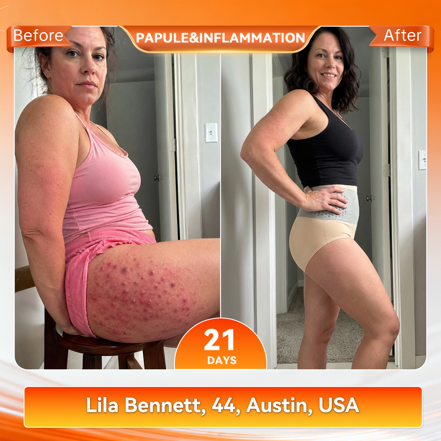 🔥 𝐎𝐟𝐟𝐢𝐜𝐢𝐚𝐥 𝐁𝐫𝐚𝐧𝐝 𝐒𝐭𝐨𝐫𝐞 | 𝐏𝐀𝐔𝐑𝐀𝐉𝐔® 𝟐𝟎𝟐𝟔 𝐌𝐨𝐫𝐢𝐧𝐠𝐚 & 𝐁𝐞𝐫𝐛𝐞𝐫𝐢𝐧𝐞 𝟒-𝐈𝐧-𝟏 𝐌𝐢𝐜𝐫𝐨-𝐏𝐚𝐫𝐭𝐢𝐜𝐥𝐞 𝐒𝐜𝐮𝐥𝐩𝐭𝐢𝐧𝐠 & 𝐅𝐚𝐭-𝐁𝐮𝐫𝐧 𝐒𝐡𝐨𝐫𝐭𝐬☄️