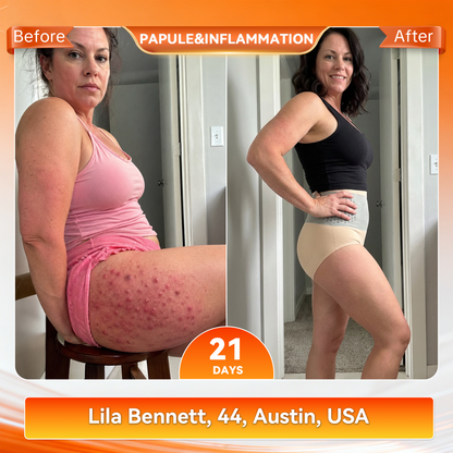 🔥 𝐎𝐟𝐟𝐢𝐜𝐢𝐚𝐥 𝐁𝐫𝐚𝐧𝐝 𝐒𝐭𝐨𝐫𝐞 | 𝐏𝐀𝐔𝐑𝐀𝐉𝐔® 𝟐𝟎𝟐𝟔 𝐌𝐨𝐫𝐢𝐧𝐠𝐚 & 𝐁𝐞𝐫𝐛𝐞𝐫𝐢𝐧𝐞 𝟒-𝐈𝐧-𝟏 𝐌𝐢𝐜𝐫𝐨-𝐏𝐚𝐫𝐭𝐢𝐜𝐥𝐞 𝐒𝐜𝐮𝐥𝐩𝐭𝐢𝐧𝐠 & 𝐅𝐚𝐭-𝐁𝐮𝐫𝐧 𝐒𝐡𝐨𝐫𝐭𝐬☄️