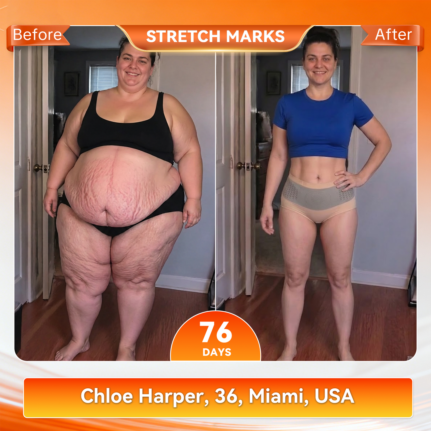 🔥 𝐎𝐟𝐟𝐢𝐜𝐢𝐚𝐥 𝐁𝐫𝐚𝐧𝐝 𝐒𝐭𝐨𝐫𝐞 | 𝐏𝐀𝐔𝐑𝐀𝐉𝐔® 𝟐𝟎𝟐𝟔 𝐌𝐨𝐫𝐢𝐧𝐠𝐚 & 𝐁𝐞𝐫𝐛𝐞𝐫𝐢𝐧𝐞 𝟒-𝐈𝐧-𝟏 𝐌𝐢𝐜𝐫𝐨-𝐏𝐚𝐫𝐭𝐢𝐜𝐥𝐞 𝐒𝐜𝐮𝐥𝐩𝐭𝐢𝐧𝐠 & 𝐅𝐚𝐭-𝐁𝐮𝐫𝐧 𝐒𝐡𝐨𝐫𝐭𝐬☄️