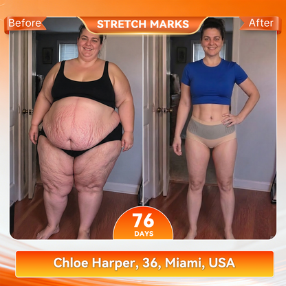 🔥 𝐎𝐟𝐟𝐢𝐜𝐢𝐚𝐥 𝐁𝐫𝐚𝐧𝐝 𝐒𝐭𝐨𝐫𝐞 | 𝐏𝐀𝐔𝐑𝐀𝐉𝐔® 𝟐𝟎𝟐𝟔 𝐌𝐨𝐫𝐢𝐧𝐠𝐚 & 𝐁𝐞𝐫𝐛𝐞𝐫𝐢𝐧𝐞 𝟒-𝐈𝐧-𝟏 𝐌𝐢𝐜𝐫𝐨-𝐏𝐚𝐫𝐭𝐢𝐜𝐥𝐞 𝐒𝐜𝐮𝐥𝐩𝐭𝐢𝐧𝐠 & 𝐅𝐚𝐭-𝐁𝐮𝐫𝐧 𝐒𝐡𝐨𝐫𝐭𝐬☄️