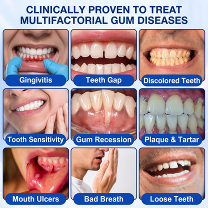 👨‍⚕️🦷✨Glimmerly® GumRevive periodontal repair gel