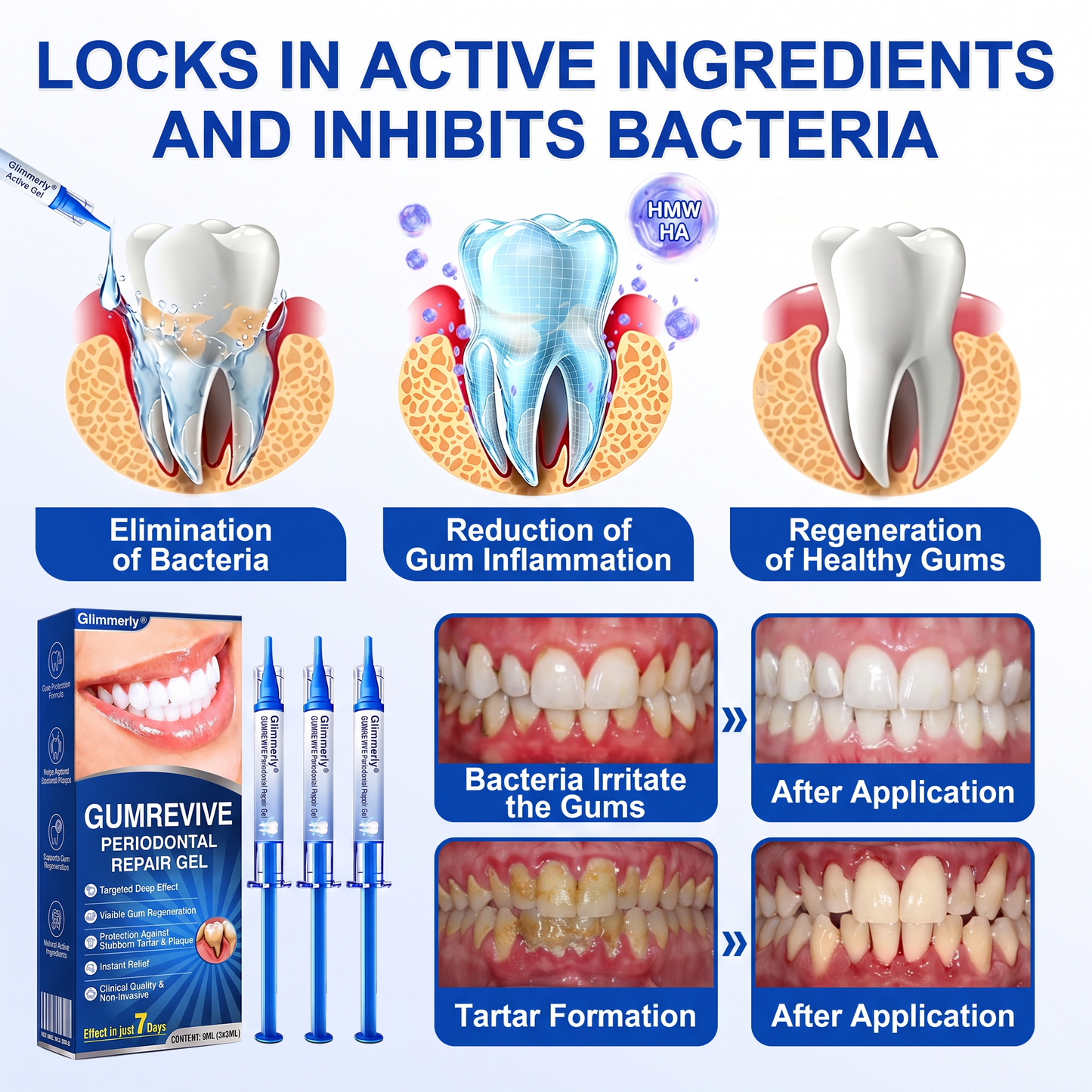 👨‍⚕️🦷✨Glimmerly® GumRevive periodontal repair gel