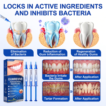 👨‍⚕️🦷✨Glimmerly® GumRevive periodontal repair gel